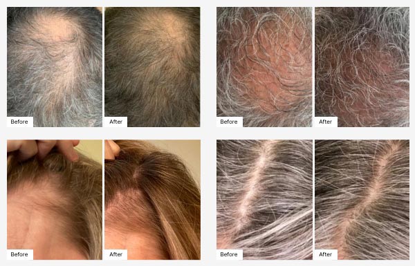 Images of before and after use of ProLuxe Scalp Treatment.