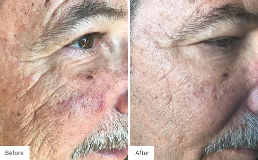 3 - Before and After Real Results image for Age IQ Night Cream