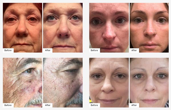 Images of actual customers' Before & After photos displaying their Real Results with Age IQ Night Cream.